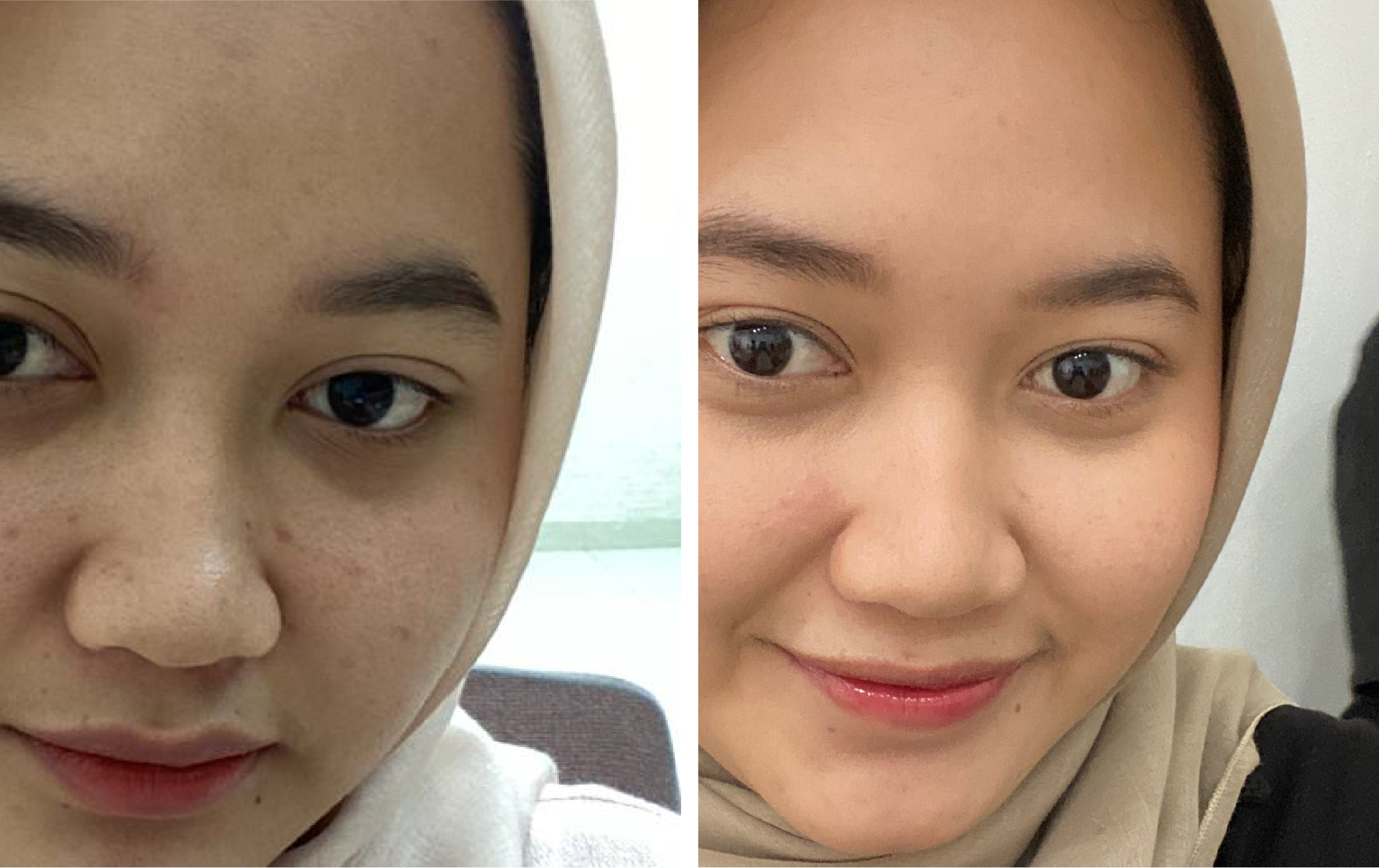 testi moni detcha-46