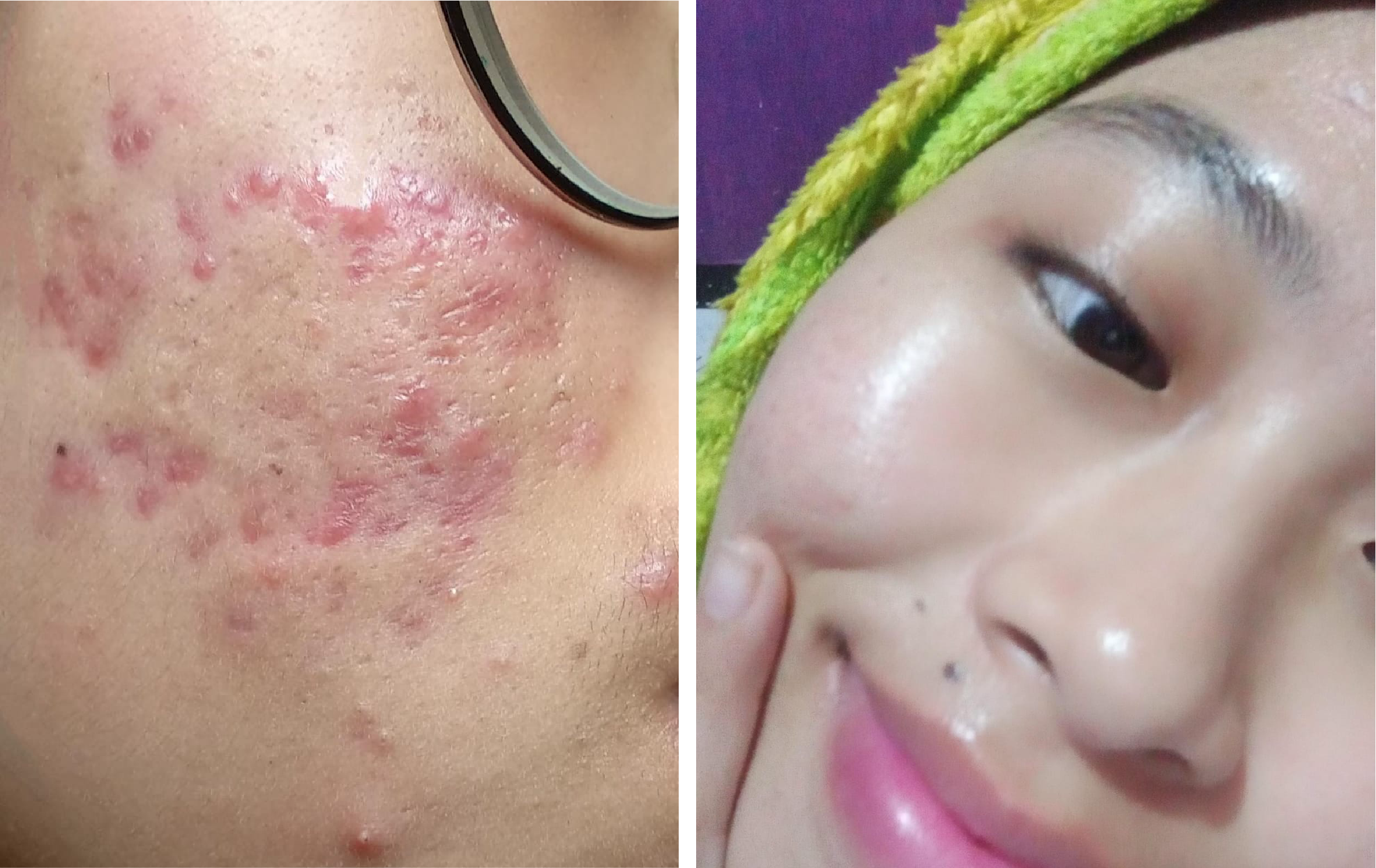 testi moni detcha-48